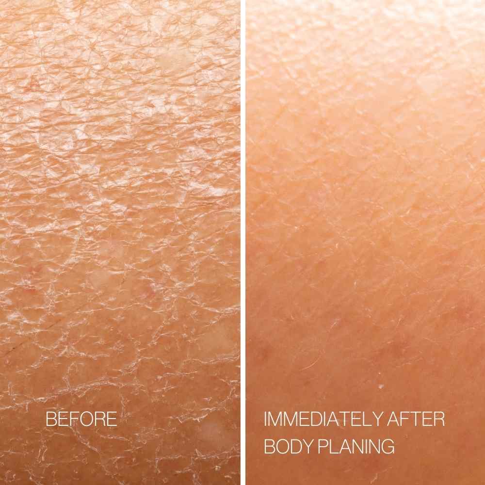 Body Plane Set